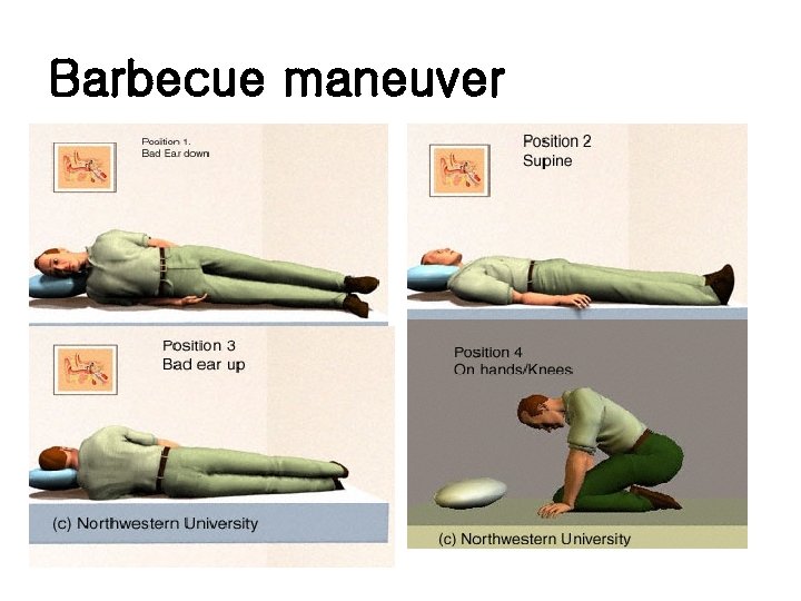 Barbecue maneuver 