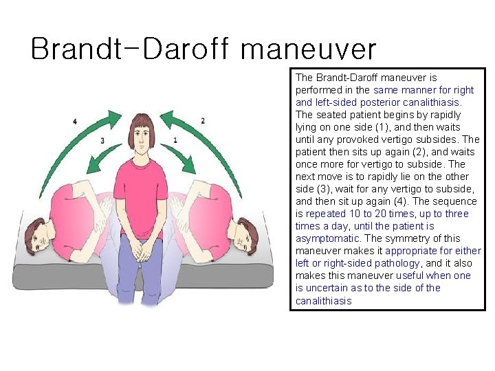 Brandt-Daroff maneuver The Brandt-Daroff maneuver is performed in the same manner for right and