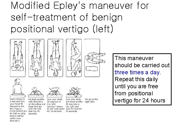 Modified Epley's maneuver for self-treatment of benign positional vertigo (left) This maneuver should be