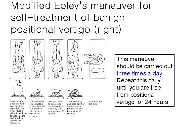 Modified Epley's maneuver for self-treatment of benign positional vertigo (right) This maneuver should be