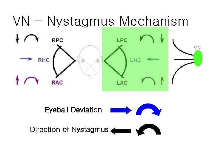 VN - Nystagmus Mechanism VN Eyeball Deviation Direction of Nystagmus 