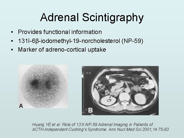 Adrenal Scintigraphy • Provides functional information • 131 I-6β-iodomethyl-19 -norcholesterol (NP-59) • Marker of