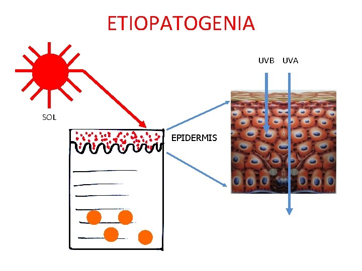 ETIOPATOGENIA UVB UVA SOL EPIDERMIS ETIOPATOGENIA UVB UVA SOL EPIDERMIS