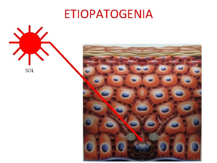ETIOPATOGENIA SOL 9 a. m. - 4 p. m. EPIDERMIS ETIOPATOGENIA SOL 9 a. m. - 4 p. m. EPIDERMIS