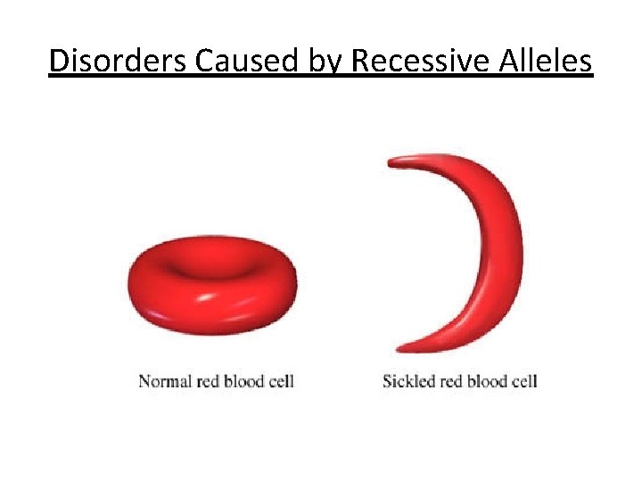 Disorders Caused by Recessive Alleles 