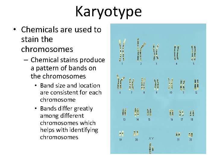 Karyotype • Chemicals are used to stain the chromosomes – Chemical stains produce a