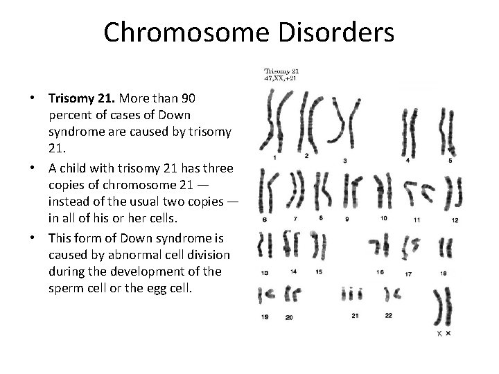 Chromosome Disorders • Trisomy 21. More than 90 percent of cases of Down syndrome