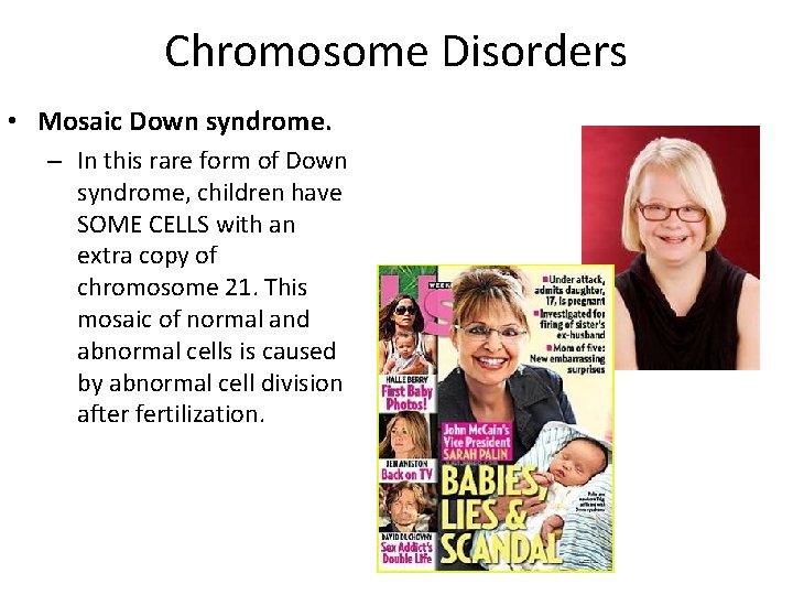 Chromosome Disorders • Mosaic Down syndrome. – In this rare form of Down syndrome,