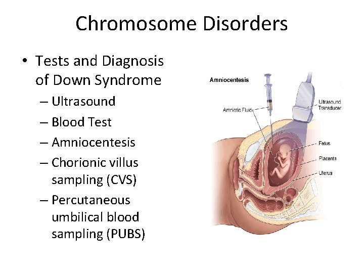 Chromosome Disorders • Tests and Diagnosis of Down Syndrome – Ultrasound – Blood Test