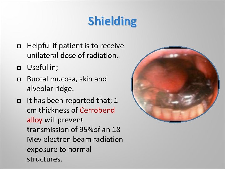 Shielding Helpful if patient is to receive unilateral dose of radiation. Useful in; Buccal Shielding Helpful if patient is to receive unilateral dose of radiation. Useful in; Buccal