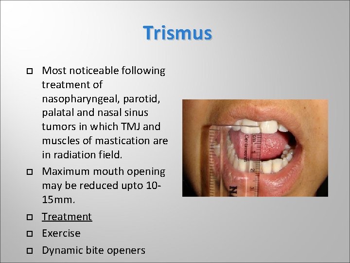 Trismus Most noticeable following treatment of nasopharyngeal, parotid, palatal and nasal sinus tumors in Trismus Most noticeable following treatment of nasopharyngeal, parotid, palatal and nasal sinus tumors in