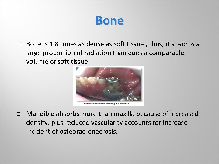 Bone is 1. 8 times as dense as soft tissue , thus, it absorbs Bone is 1. 8 times as dense as soft tissue , thus, it absorbs