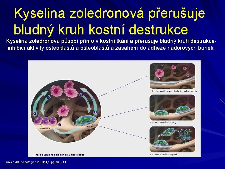 Kyselina zoledronová přerušuje bludný kruh kostní destrukce Kyselina zoledronová působí přímo v kostní tkáni