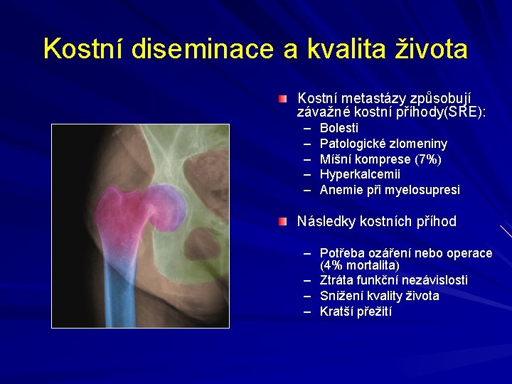 Kostní diseminace a kvalita života Kostní metastázy způsobují závažné kostní příhody(SRE): – – –