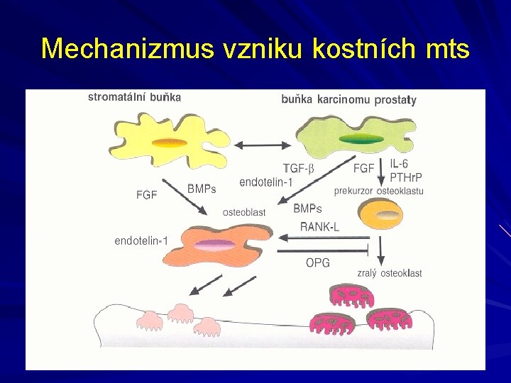 Mechanizmus vzniku kostních mts 