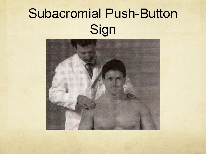 Subacromial Push-Button Sign 