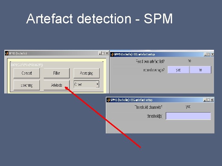 Artefact detection - SPM 