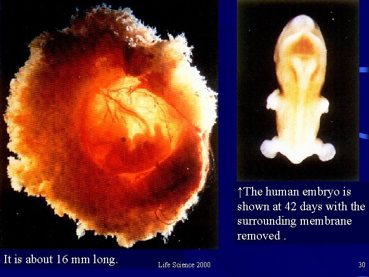 ↑The human embryo is shown at 42 days with the surrounding membrane removed. It