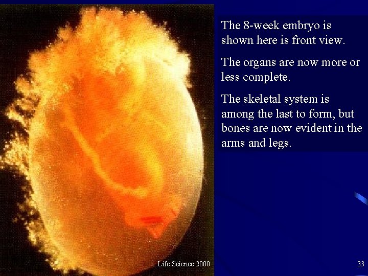 The 8 -week embryo is shown here is front view. The organs are now