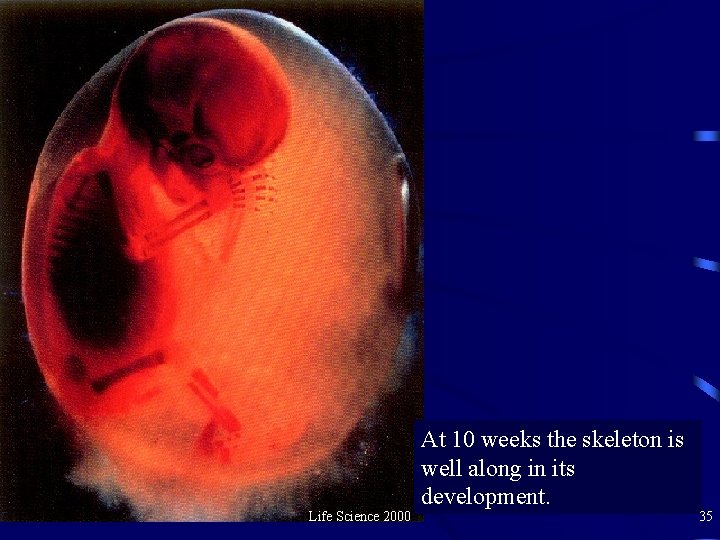 Life Science 2000 At 10 weeks the skeleton is well along in its development.