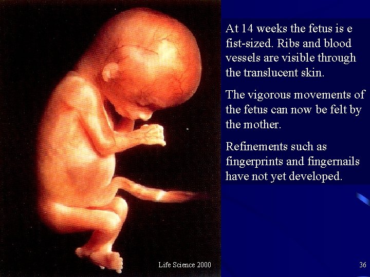 At 14 weeks the fetus is e fist-sized. Ribs and blood vessels are visible