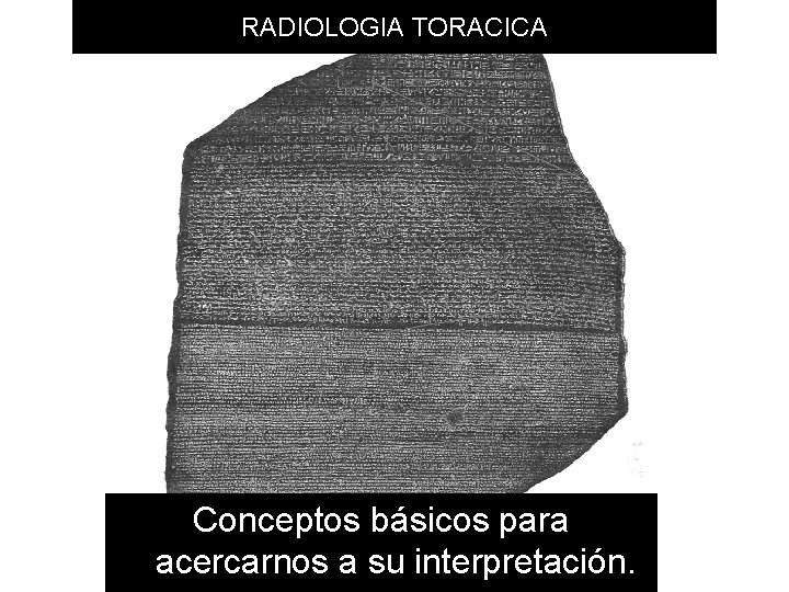 RADIOLOGIA TORACICA Conceptos básicos para acercarnos a su interpretación. 