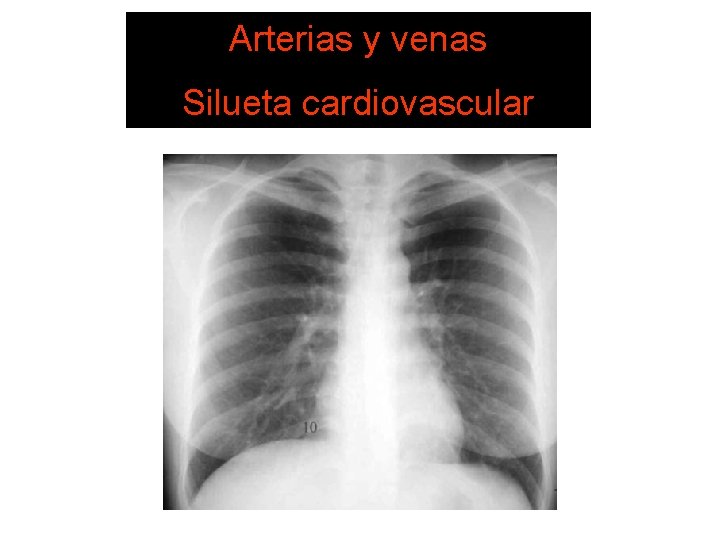 Arterias y venas DE LECTURA 6. SISTEMA Estructuras vasculares Silueta cardiovascular 