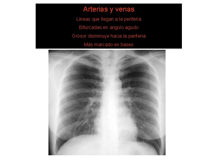 Arterias y venas Lineas que DE llegan LECTURA a la periferia SISTEMA 6. Estructuras