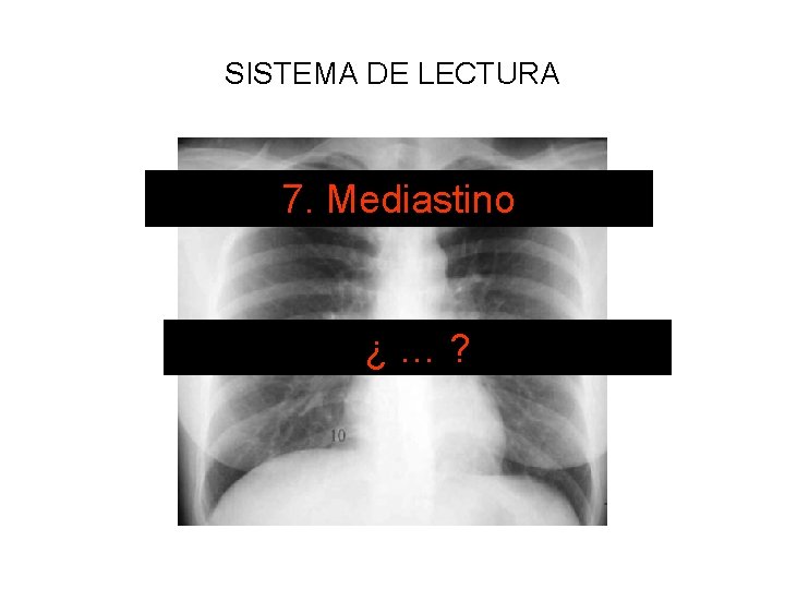 SISTEMA DE LECTURA 7. Mediastino ¿…? 