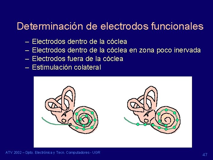 Determinación de electrodos funcionales – – Electrodos dentro de la cóclea en zona poco Determinación de electrodos funcionales – – Electrodos dentro de la cóclea en zona poco