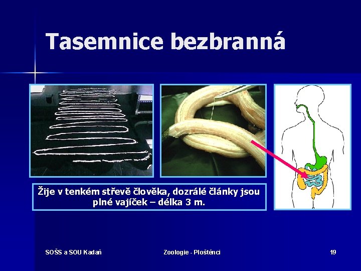 Tasemnice bezbranná Žije v tenkém střevě člověka, dozrálé články jsou plné vajíček – délka