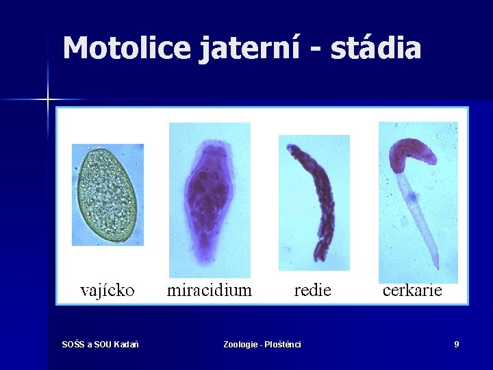 Motolice jaterní - stádia SOŠS a SOU Kadaň Zoologie - Ploštěnci 9 