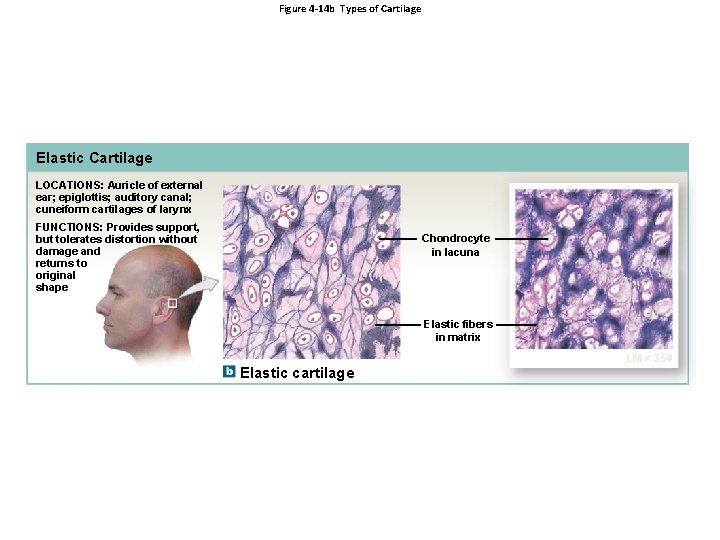 Figure 4 -14 b Types of Cartilage Elastic Cartilage LOCATIONS: Auricle of external ear;