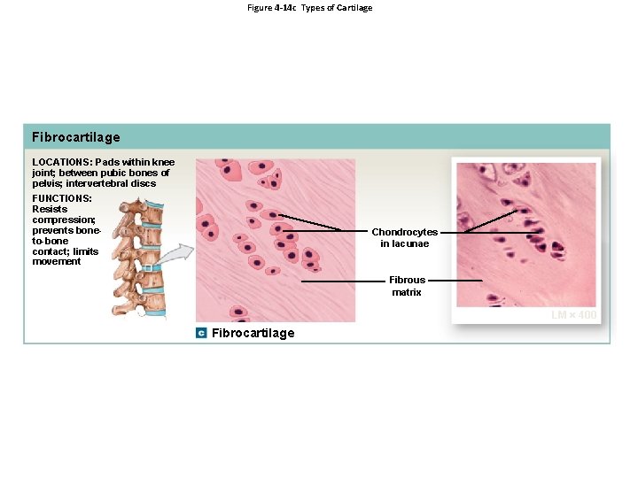 Figure 4 -14 c Types of Cartilage Fibrocartilage LOCATIONS: Pads within knee joint; between