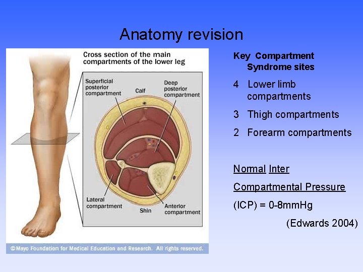 Anatomy revision Key Compartment Syndrome sites 4 Lower limb compartments 3 Thigh compartments 2