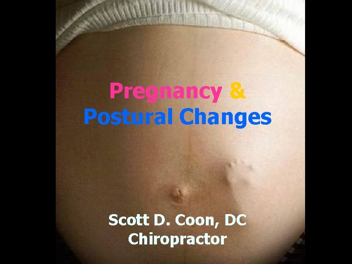 Pregnancy & Postural Changes Scott D. Coon, DC Chiropractor 