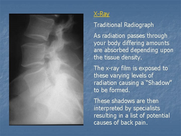 X-Ray Traditional Radiograph As radiation passes through your body differing amounts are absorbed depending