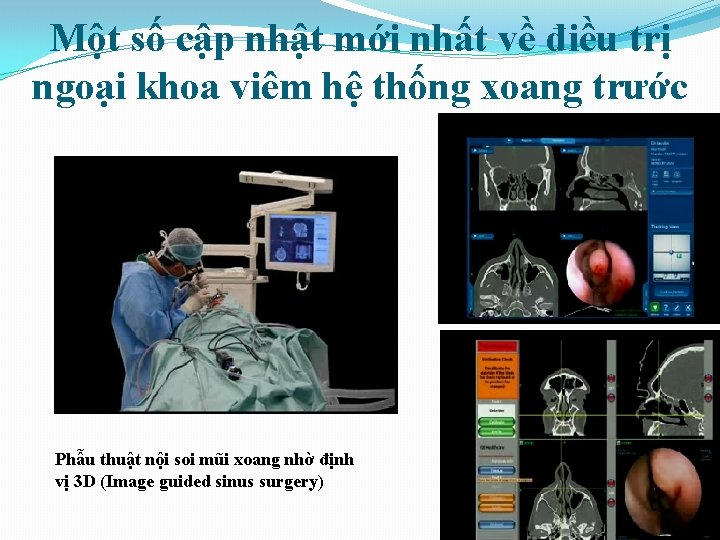 Một số cập nhật mới nhất về điều trị ngoại khoa viêm hệ thống