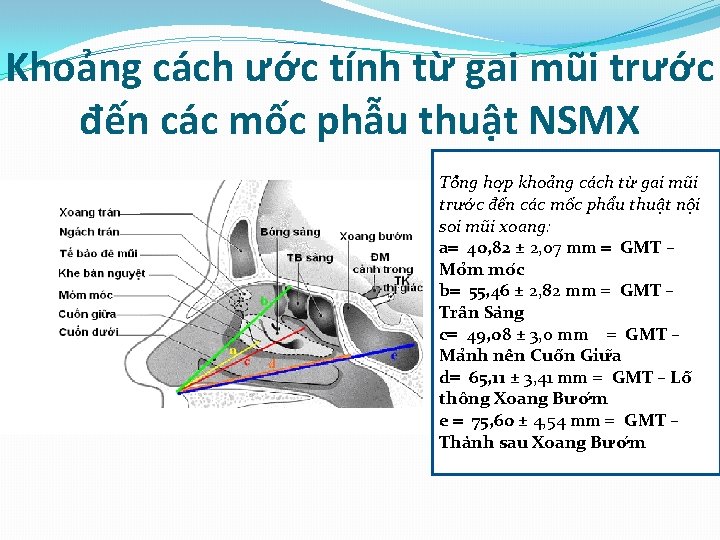 Khoảng cách ước tính từ gai mũi trước đến các mốc phẫu thuật NSMX