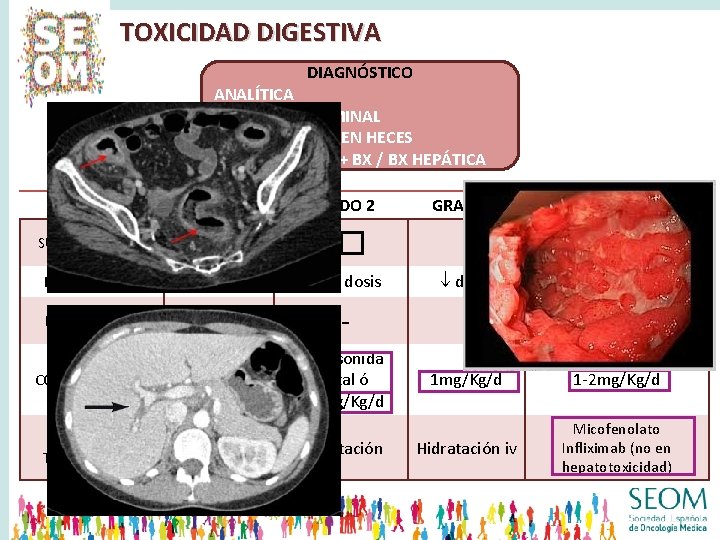 TOXICIDAD DIGESTIVA DIAGNÓSTICO ANALÍTICA ECO/TAC ABDOMINAL CALPROTECTINA EN HECES COLONOSCOPIA + BX / BX