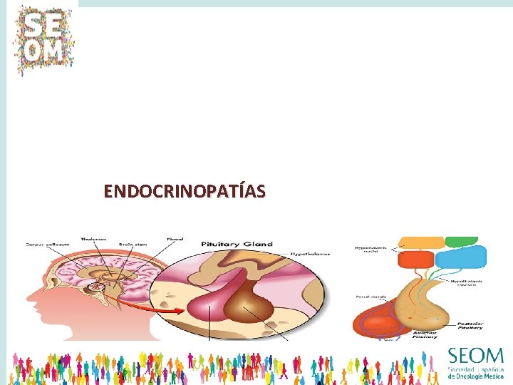 ENDOCRINOPATÍAS 