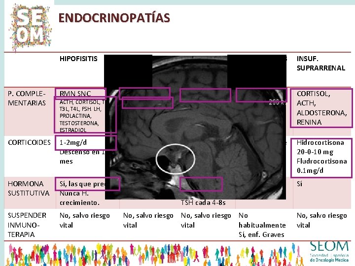 ENDOCRINOPATÍAS HIPOFISITIS TIROIDITIS HIPOTIROIDIS MO HIPERTIROIDIS MO INSUF. SUPRARRENAL P. COMPLEMENTARIAS RMN SNC ECO