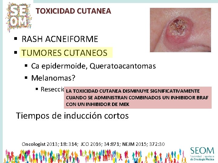 TOXICIDAD CUTANEA § RASH ACNEIFORME § TUMORES CUTANEOS § Ca epidermoide, Queratoacantomas § Melanomas?