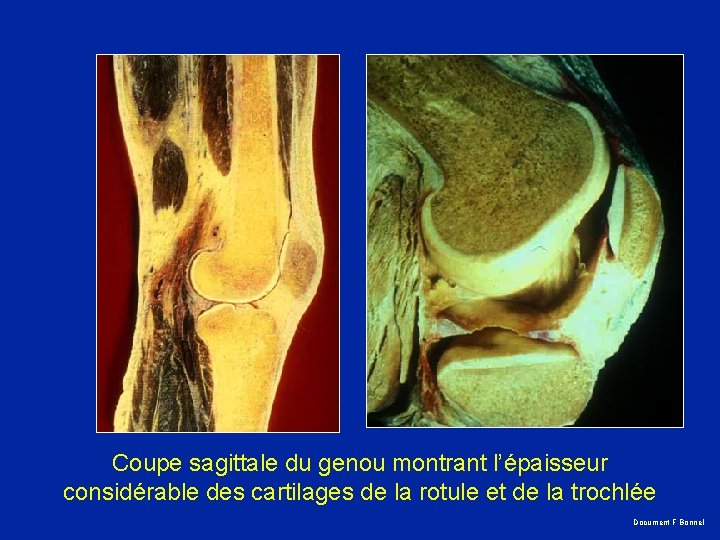 Coupe sagittale du genou montrant l’épaisseur considérable des cartilages de la rotule et de