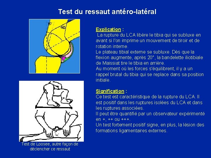  Test du ressaut antéro-latéral Explication : La rupture du LCA libère le tibia