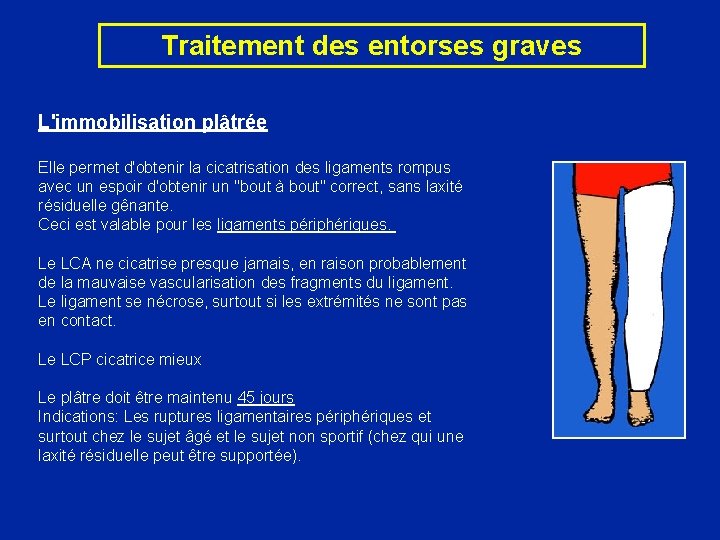 Traitement des entorses graves L'immobilisation plâtrée Elle permet d'obtenir la cicatrisation des ligaments rompus