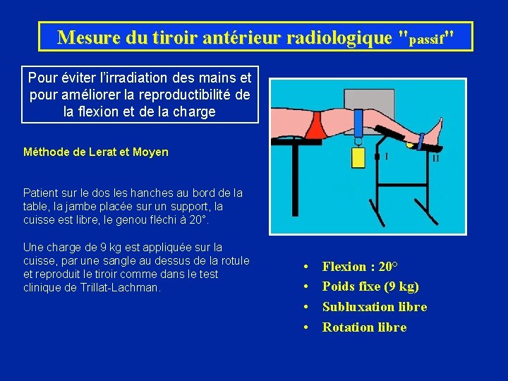 Mesure du tiroir antérieur radiologique "passif" Pour éviter l’irradiation des mains et pour améliorer