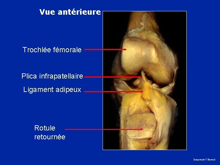 Vue antérieure Trochlée fémorale Plica infrapatellaire Ligament adipeux Rotule retournée Document F Bonnel 