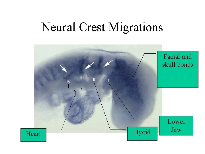 Neural Crest Migrations Facial and skull bones Heart Hyoid Lower Jaw 