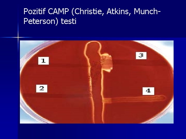 Pozitif CAMP (Christie, Atkins, Munch. Peterson) testi 